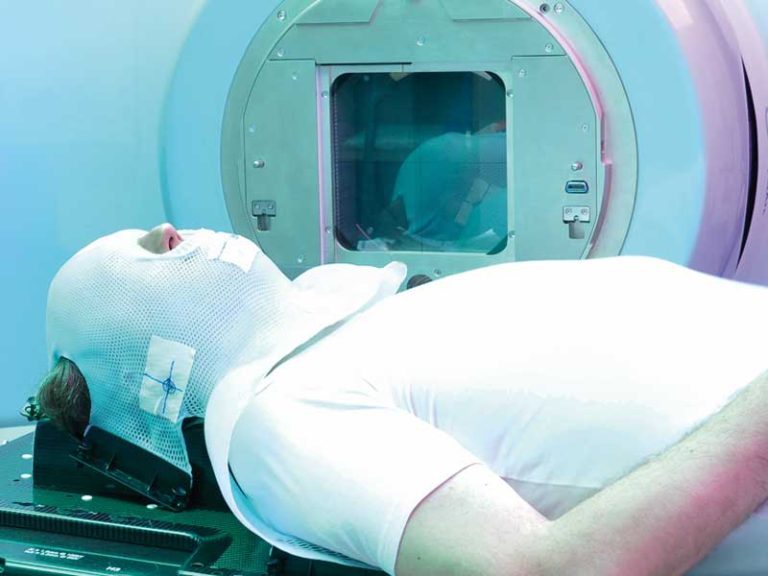 Radiotherapie Versus Chirurgie Fr Kopfhalstumoren